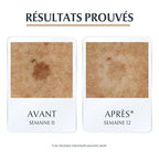 EUCERIN HYALURON-FILLER + ELASTICITY Sérum 3D